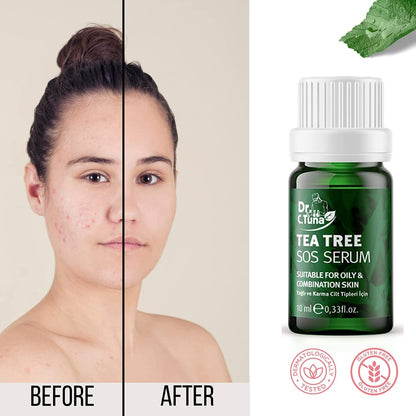 Dr. C.Tuna Tea Tree SOS Serum (10ml)