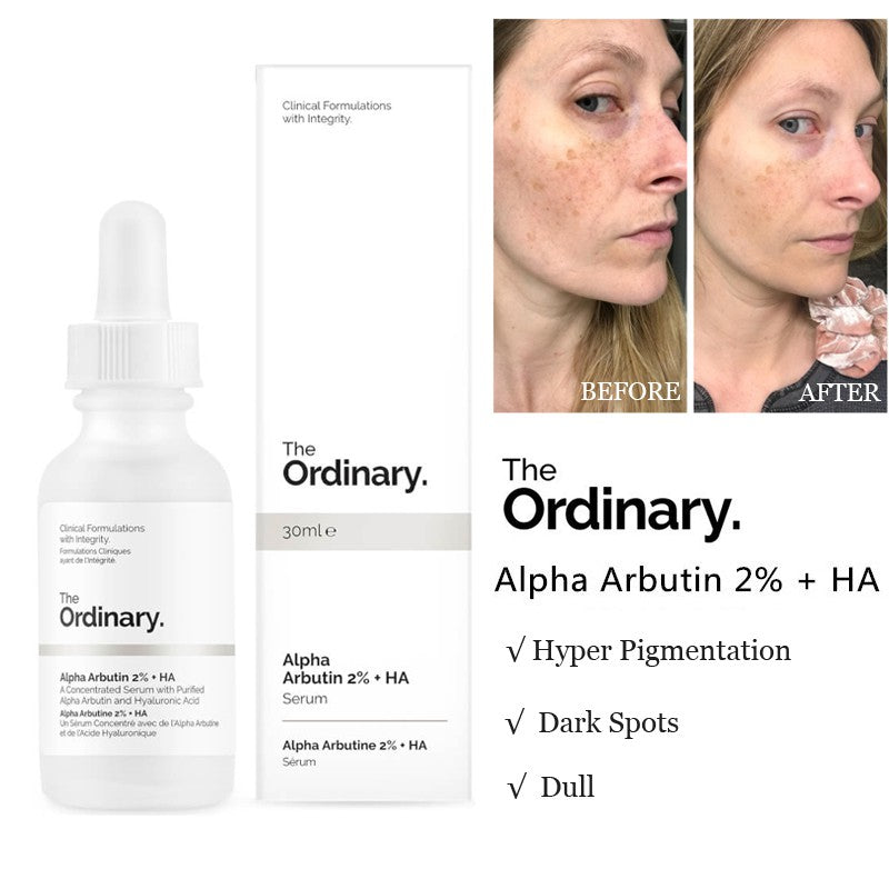 The Ordinary Alpha Arbutin 2% + HA Serum (30ml)